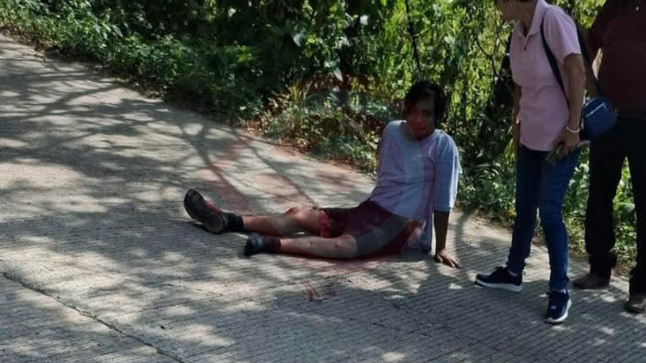 Motociclista sufre aparatosa caída en la carretera Huautla–Atlapexco